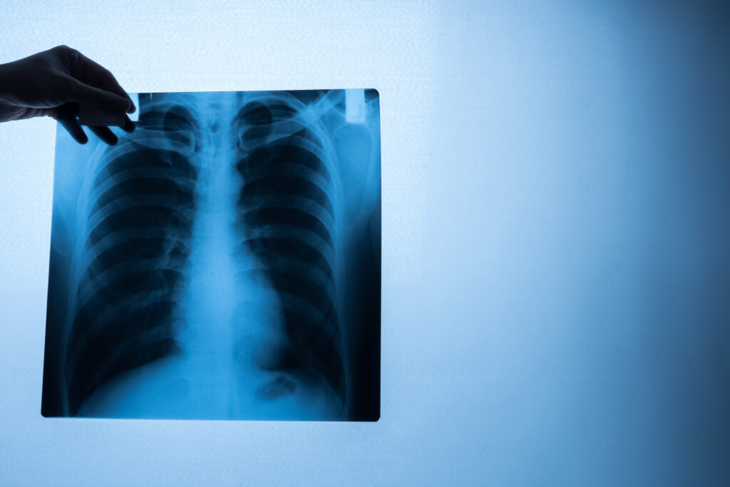 Rayos X de abdomen en panama