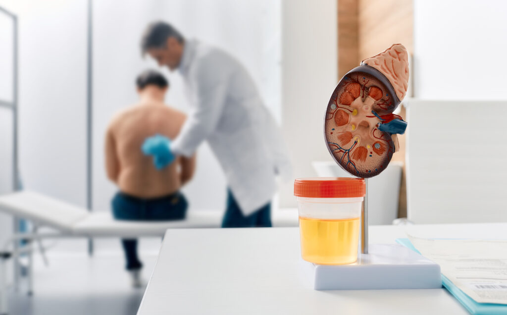 Ultrasonido para Chequeo Renal